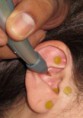 /album/fotogaleria-curso-de-auriculoterapia/auriculo-4-jpg1/